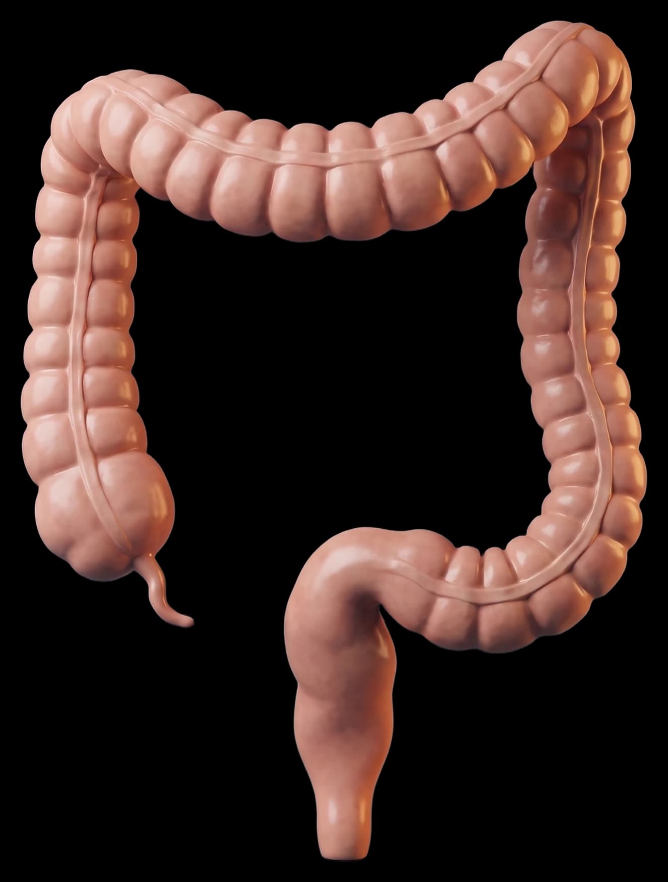 Peça anatômica do intestino grosso: ceco com o apêndice, cólon ascendente, transverso e descendente, sigmoide e reto